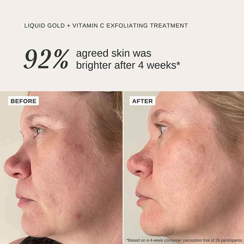 Alpha-H Liquid Gold Exfoliating Treatment with 5% Glycolic Acid and Vitamin C 100ml