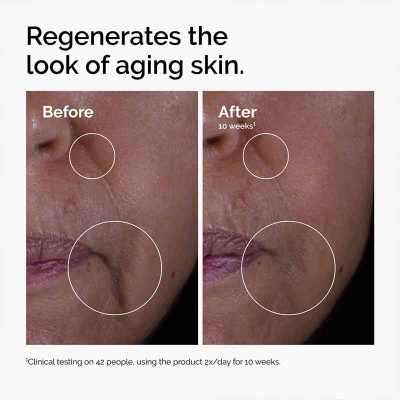 The Ordinary GF 15% Solution Growth Factor Serum