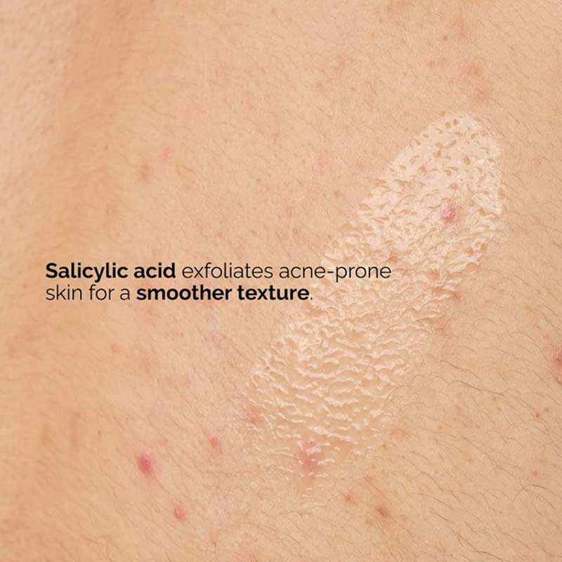 The Ordinary Salicylic Acid 0.5% Body Serum